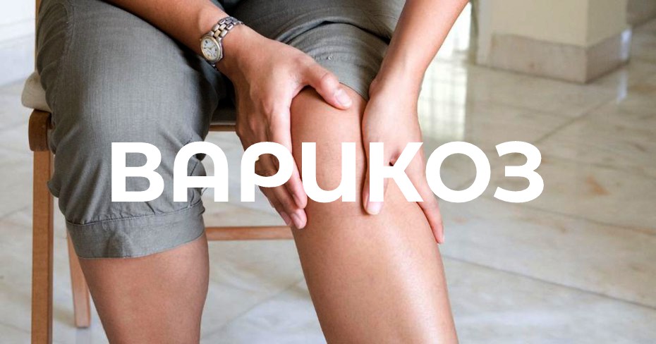 Варикозная болезнь – союз холода ваты и капхи